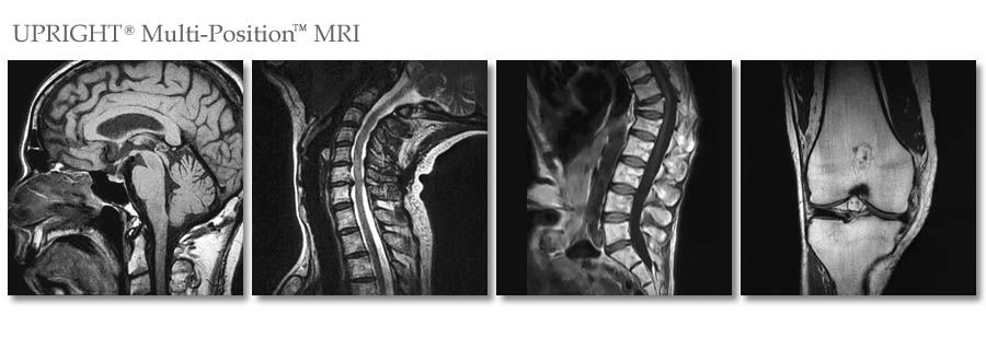 Comprehensive MRI of White Plains